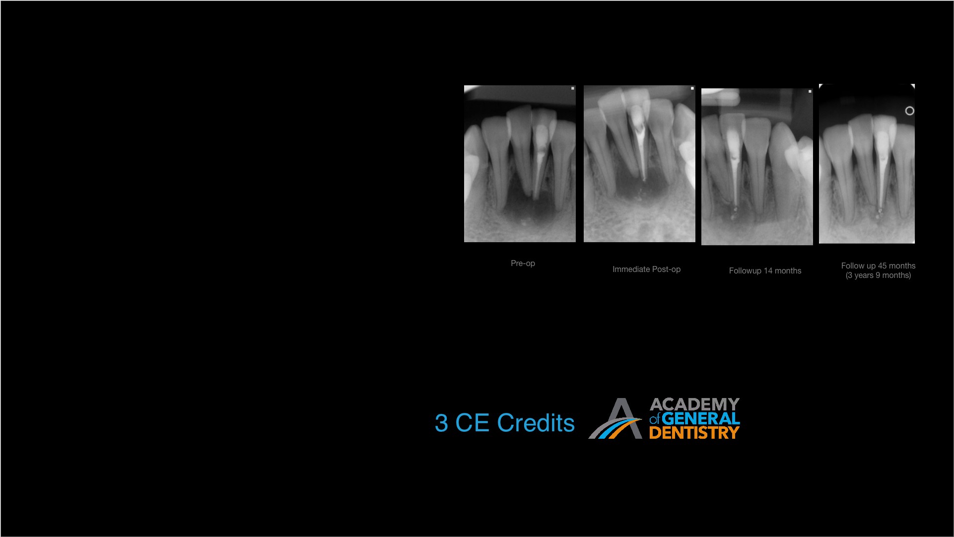 Endodontic Diagnosis 2019 EOI NYC